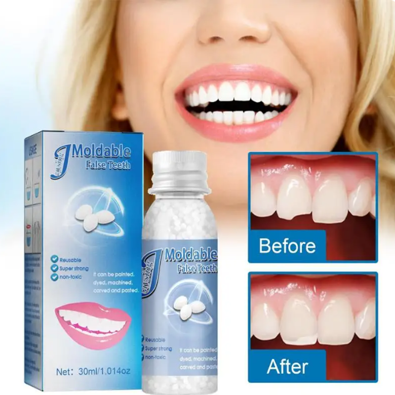 Moldable Tooth Repair Kit
