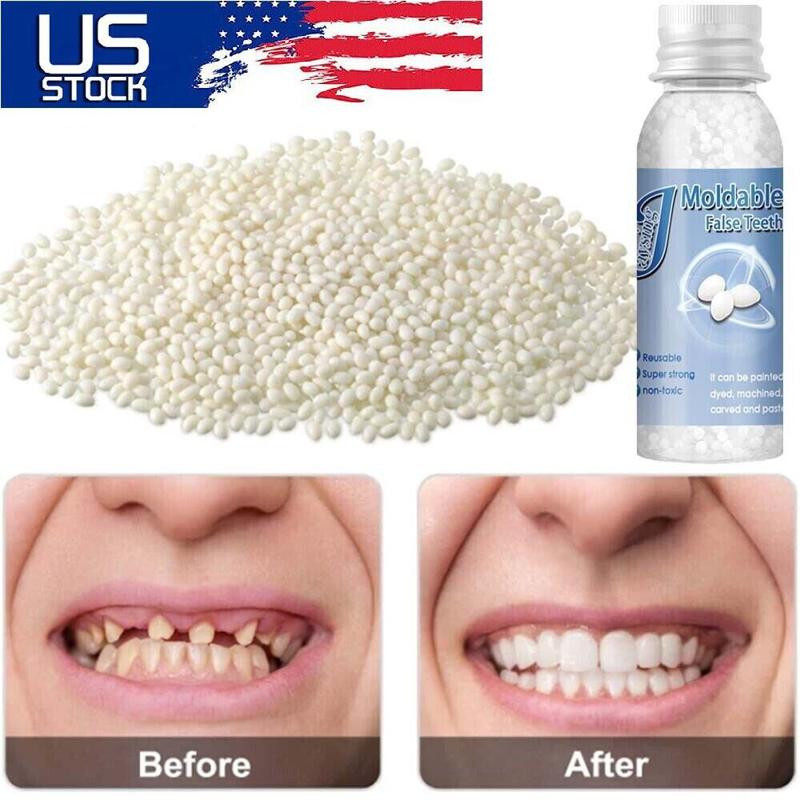 Moldable Tooth Repair Kit