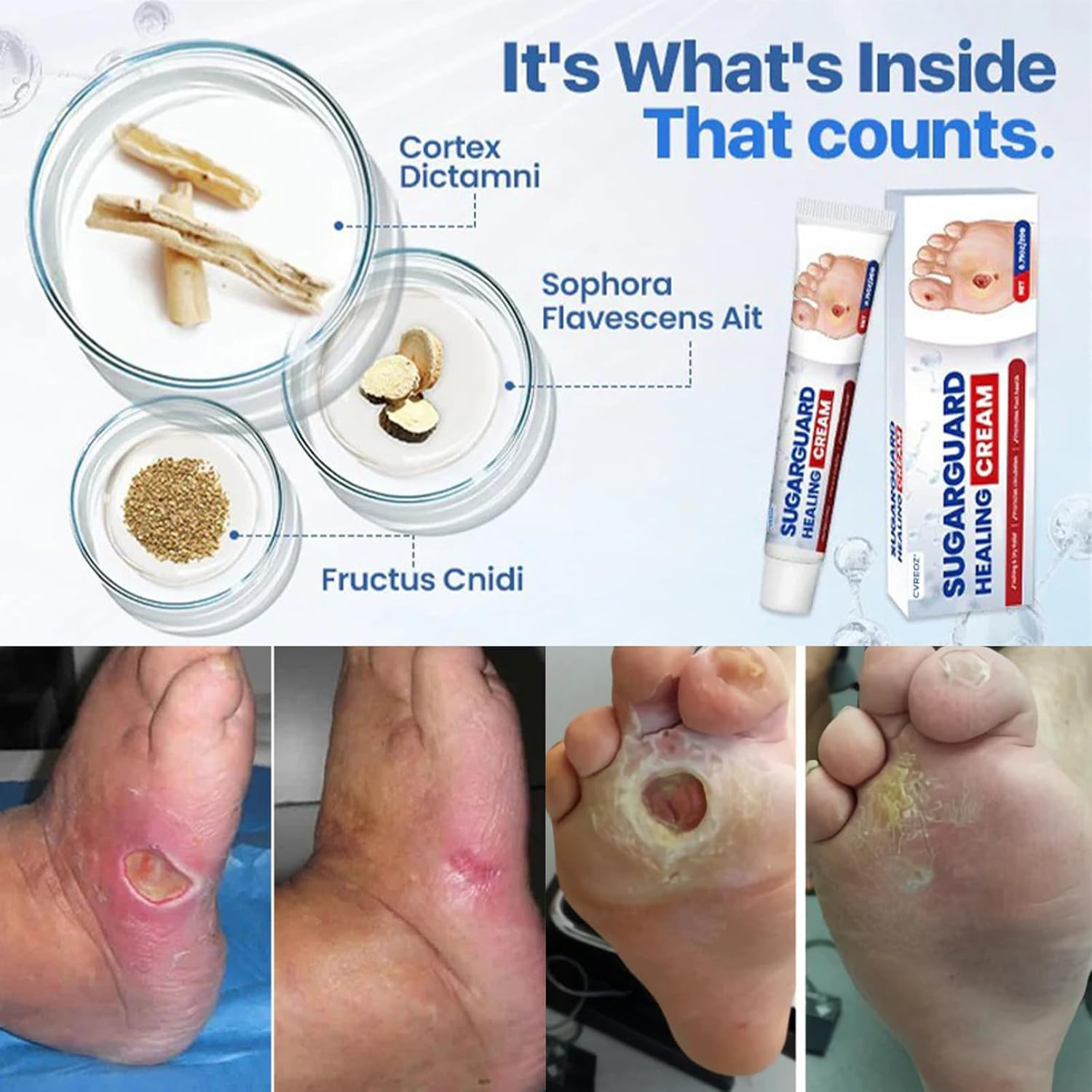 SUGAR GUARD HEALING CREAM