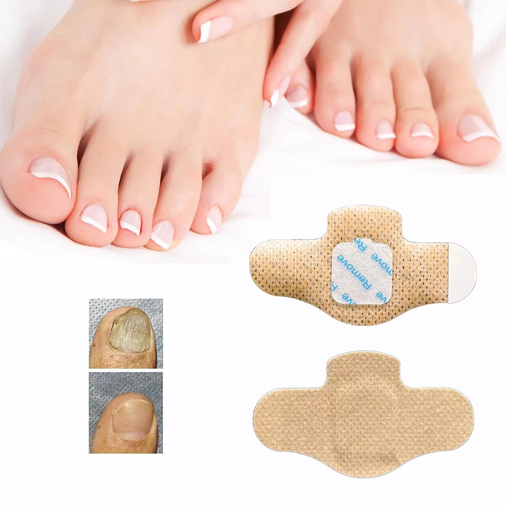 21 PCS NAIL RENEW PATCH