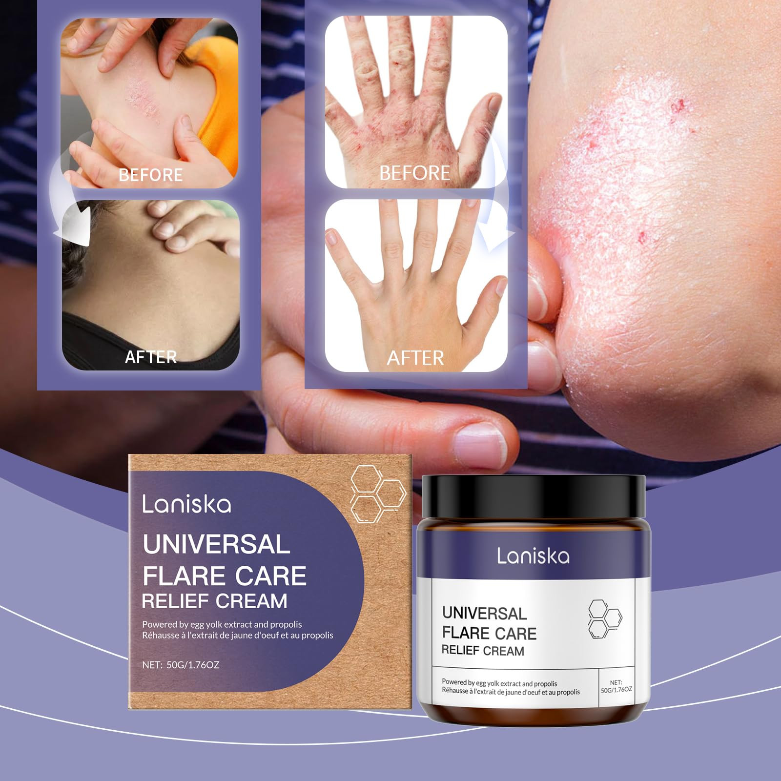 Flare Cream